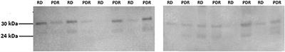 Tissue Inhibitor of Metalloproteinase-3 Ameliorates Diabetes-Induced Retinal Inflammation